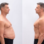 6 Week Belly Ozempic Weight Loss Before And After